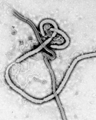 placera-Ebola viruse.PNG